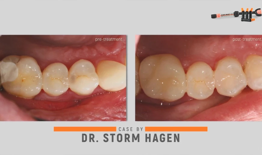 video poster