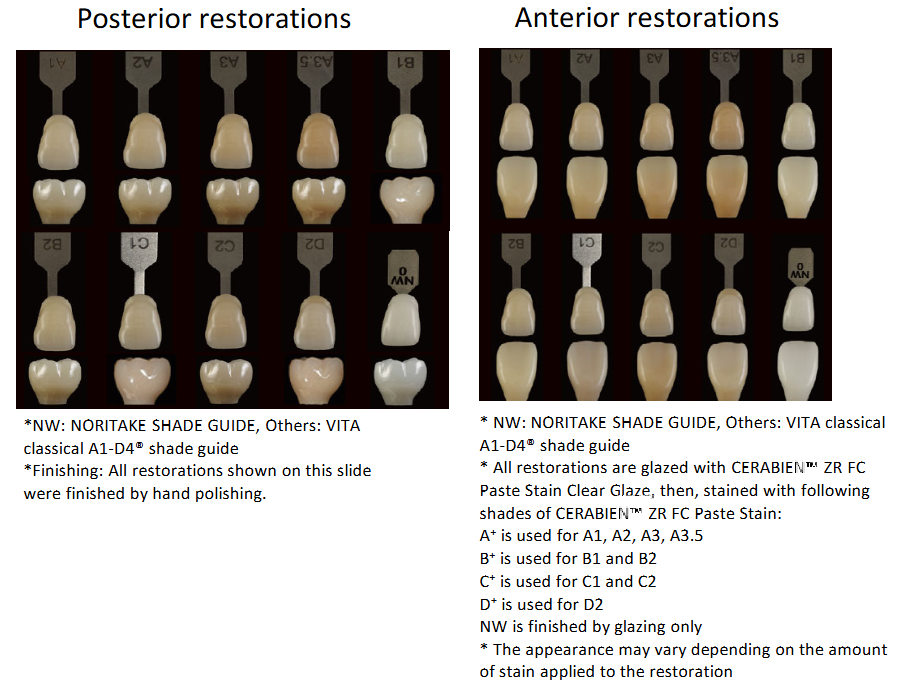 FAQ-Implant-selection