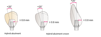 KZ1-implant-faq-01