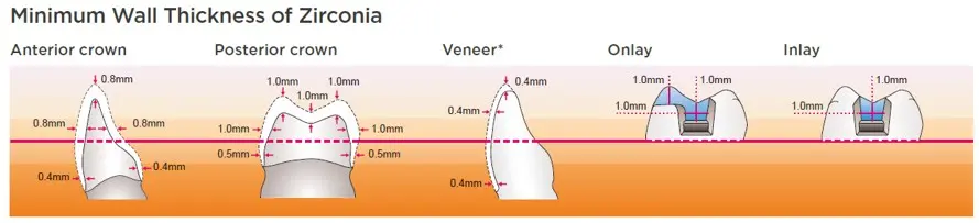 YML-FAQ-05