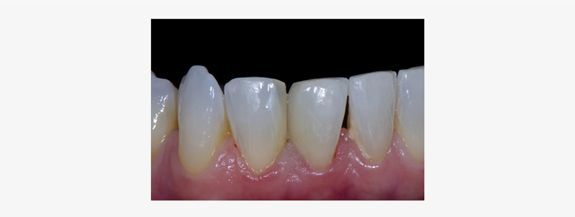 news-article-teeth-2