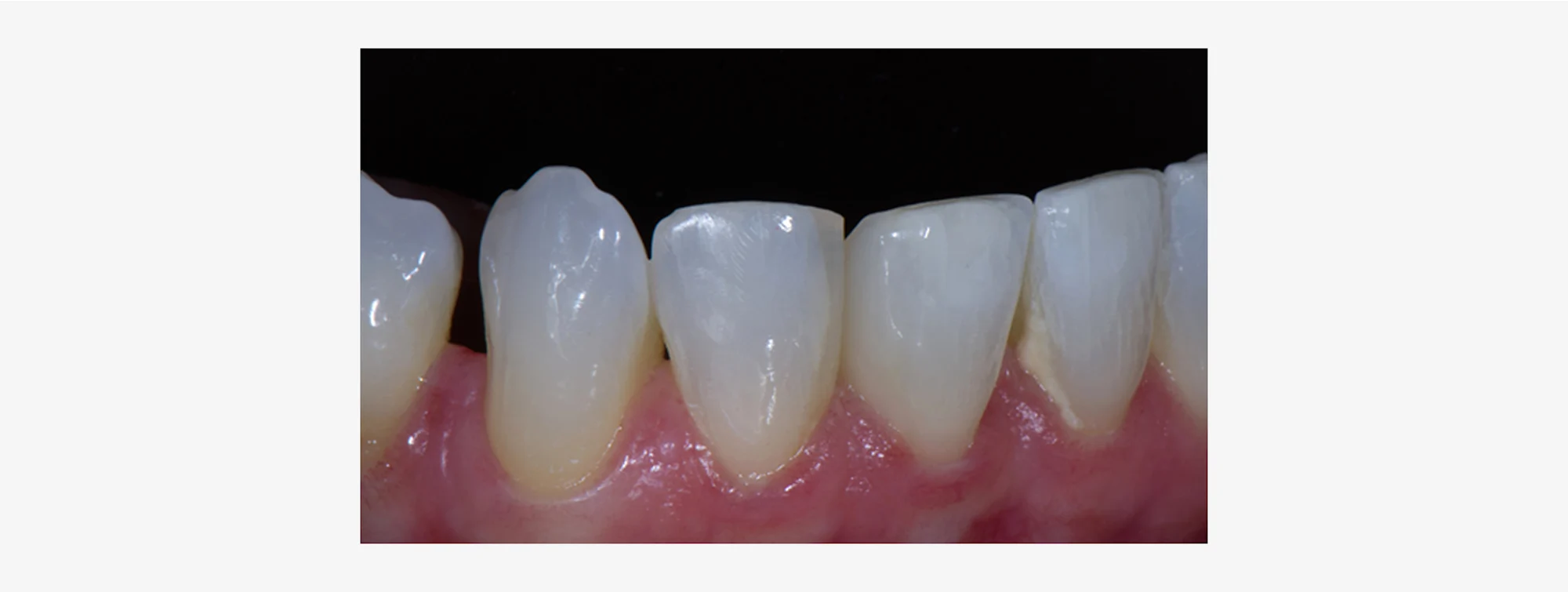 news-article-teeth-3