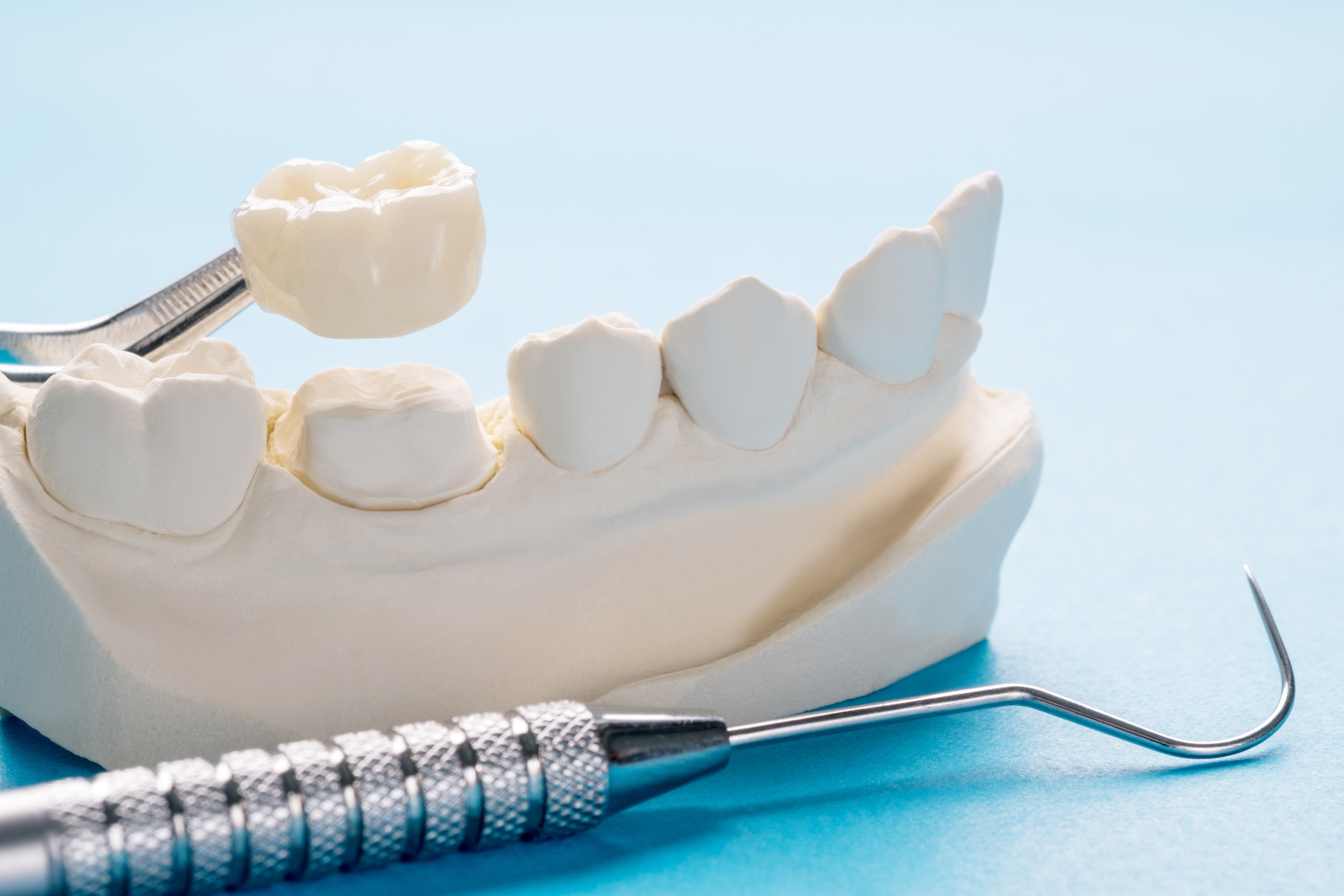 Техника протезиста. Шинирование в стоматологии. Коронка стоматология. Керамическая зубная коронка.